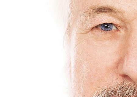 Cities With Alzheimer’s