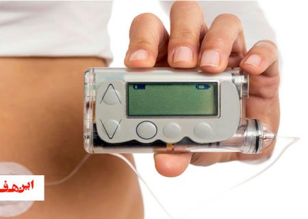 نیاز به حمایت وزارت بهداشت برای تهیه پمپ های انسولین داریم