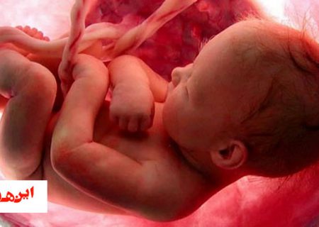 قانون ناخوش احوال