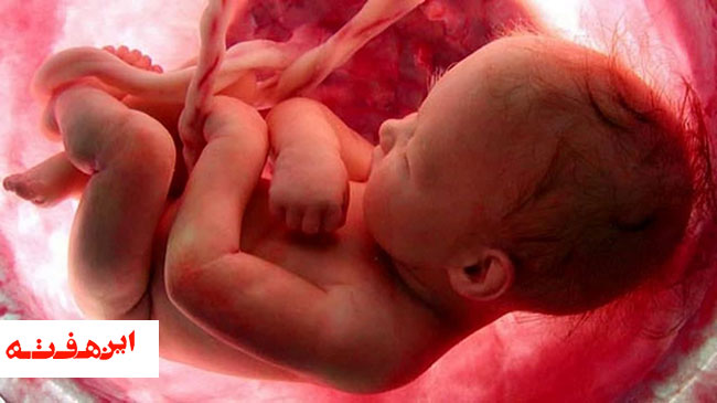 قانون ناخوش احوال